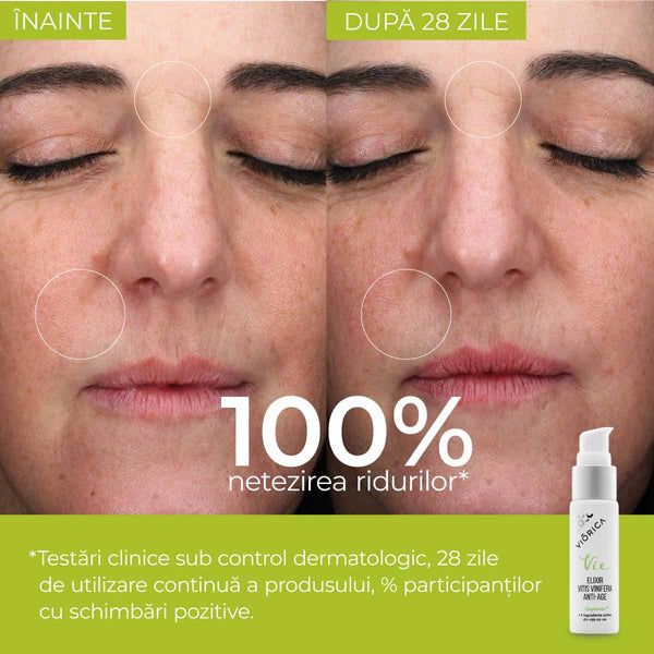 Serum „Elixir Vitis Vinifera Anti-Age”, Viorica Vie