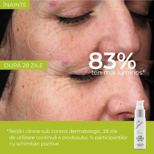 Serum „Elixir Vitis Vinifera Anti-Age”, Viorica Vie