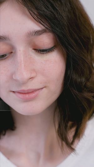 Patch-uri cu micro-ace pentru coșuri, A0